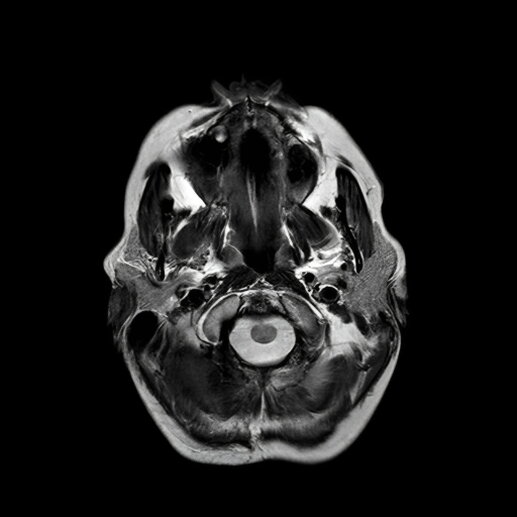 My MRI Scan